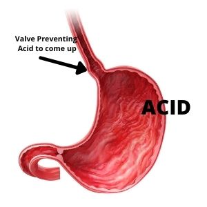 Valve preventing acid